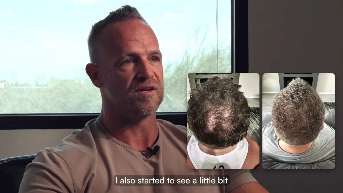 Cole Bishop, real patient